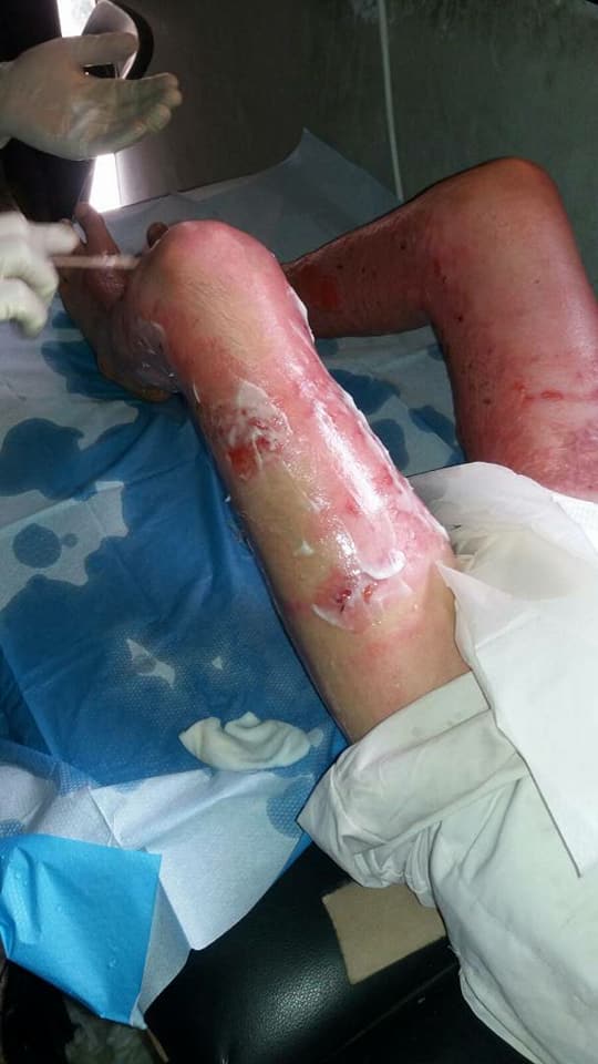 Auch und gerade für akute Fälle ist Fachwissen und Behandlung sicher! 